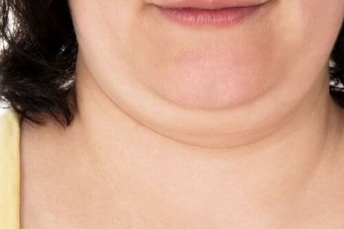 El ejercicio para eliminar la papada