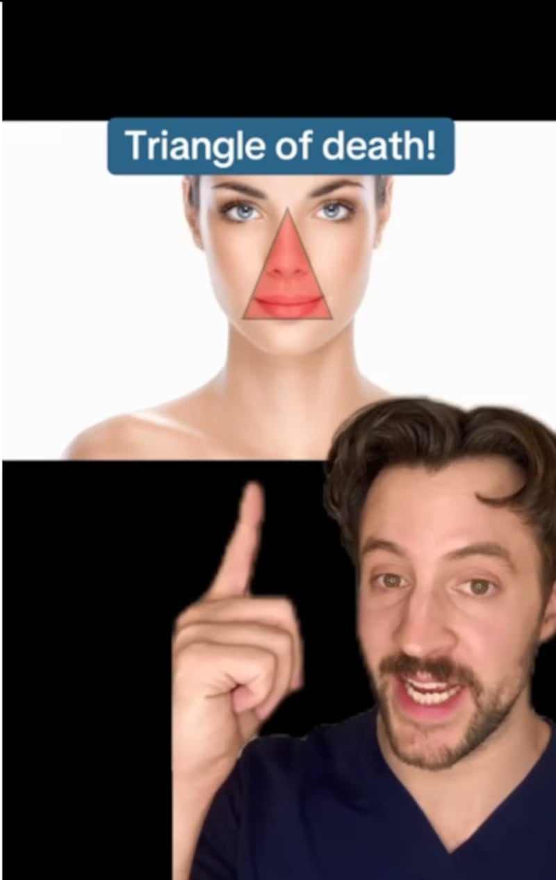 Acné