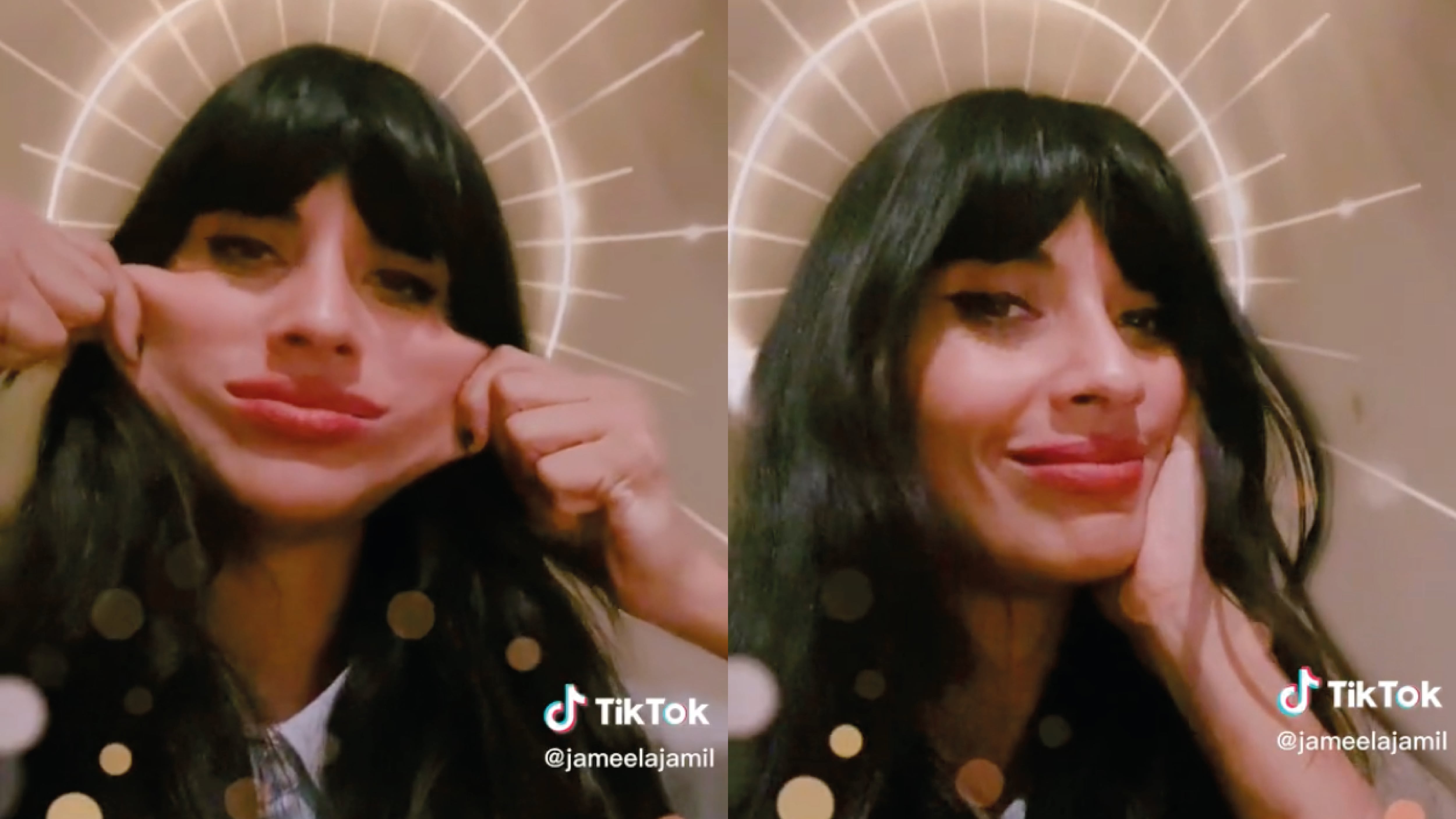 La enfermedad de Jameela que le produce que se ls estire la piel