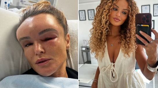 El cambio drástico que sufrió una mujer tras un accidente de tránsito - Fuente: Foto de la web