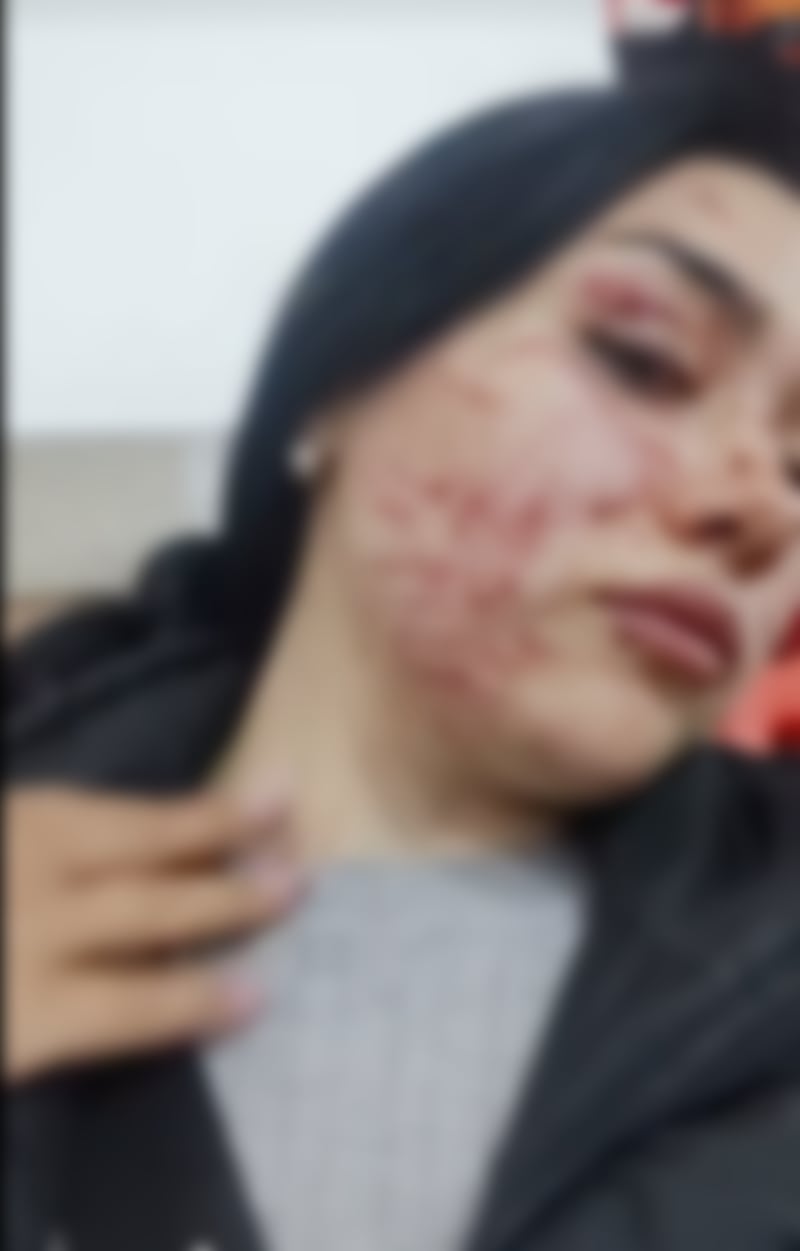Leidy vendedora informal agredida