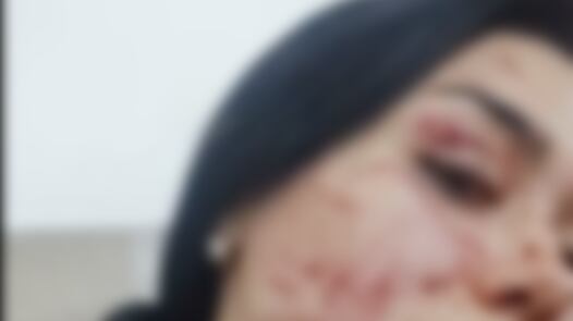 Leidy vendedora informal agredida