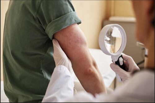 Este es el síntoma silencioso que podría alertar un cáncer y muchos ignoran