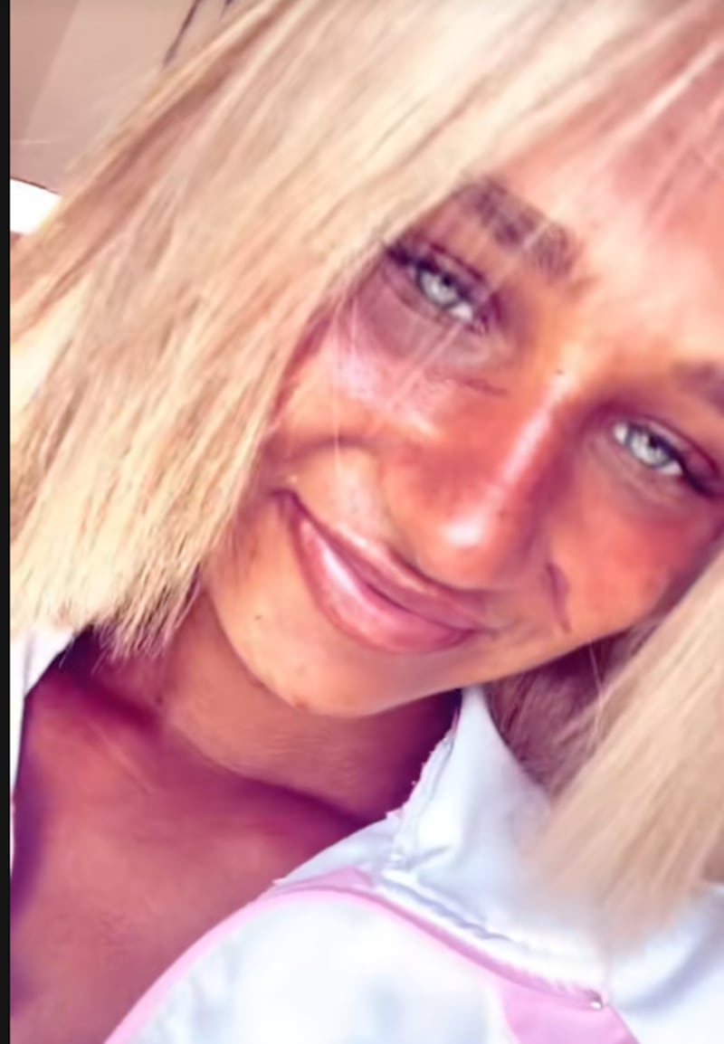 Megan Blain muestra su piel manchada por bronceado extremo