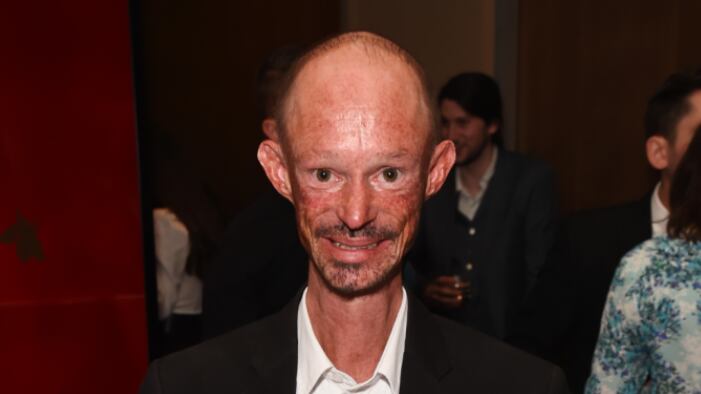 Actor de Game of Thrones muere a los 36 años.