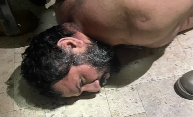 Alias Fito, cambio físico durante los años.