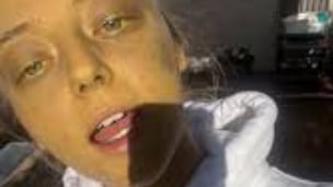 Adolescente notó que su piel se volvía amarilla y terminó necesitando un trasplante para sobrevivir - Fuente: Foto de la web