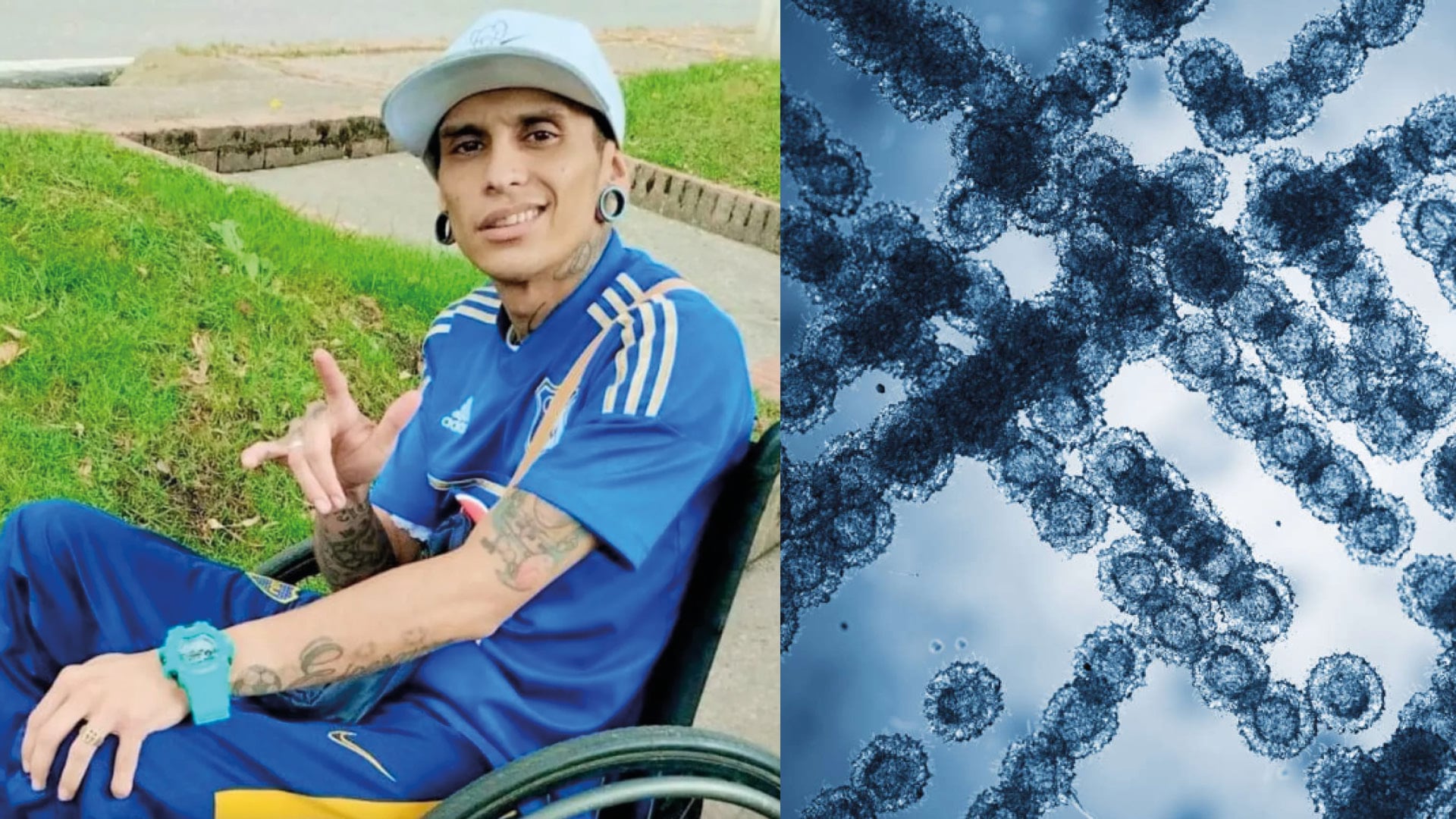 Así es el hongo Candida auris que Javier contrajo en una piscina y le provocó la muerte
