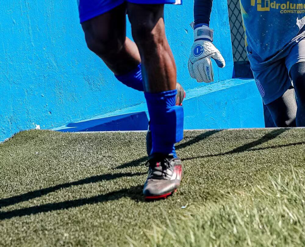 El delantero Yuri de Carvalho disputó la final carioca con una tobillera electrónica, una imagen que encendió el debate sobre reinserción y reglas del fútbol.