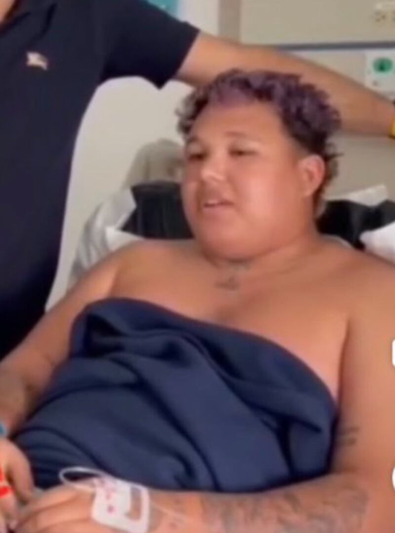 Beéle cuando tenía obesidad