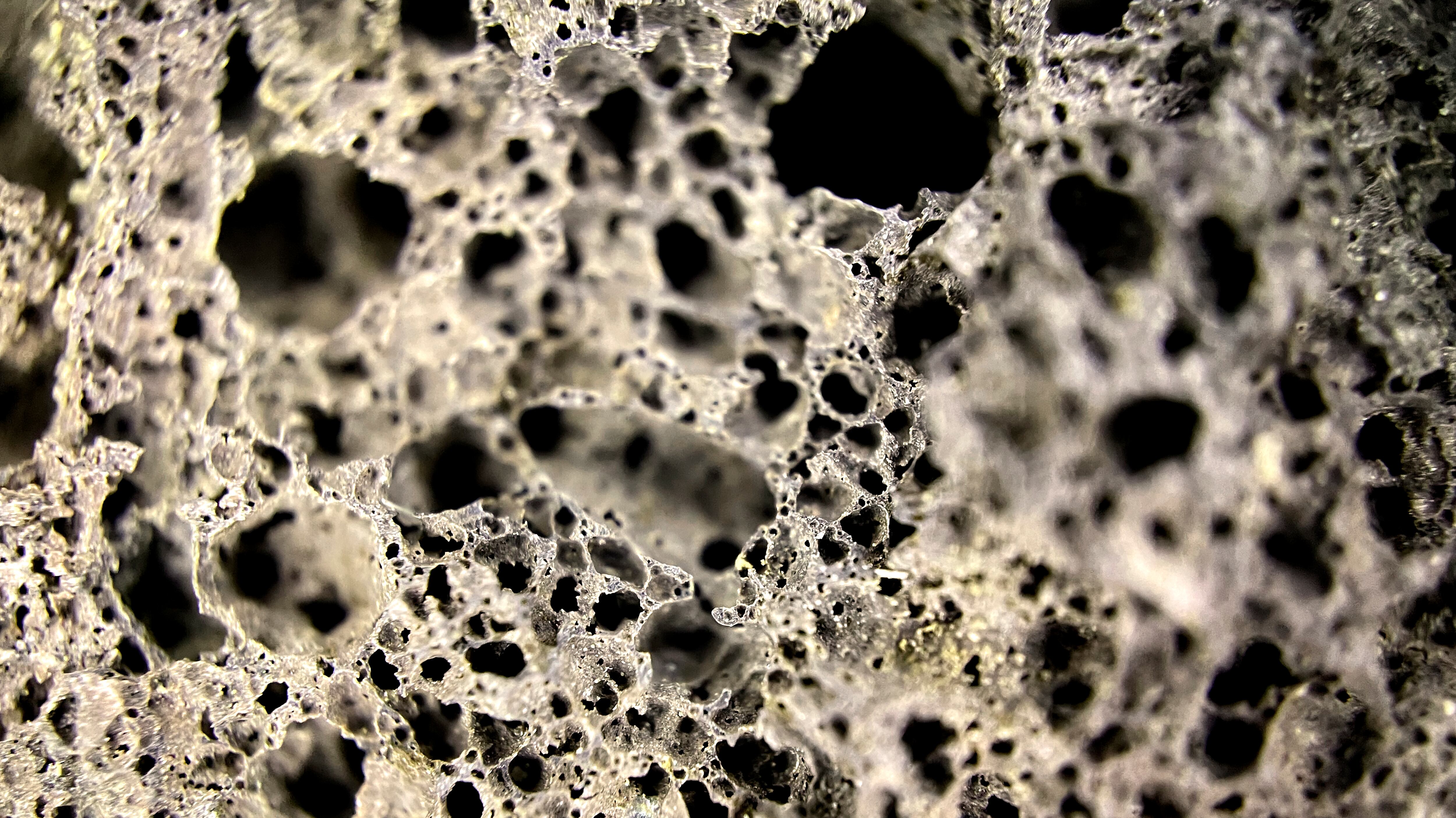 La osteoporosis es una enfermedad que hace que los huesos se debiliten y se vuelvan frágiles, en tal medida que una caída o hasta una leve tensión, como agacharse o toser, pueden causar una fractura. Foto: Freepik.