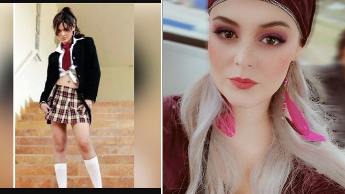 Antes y después de Alisson Lozz