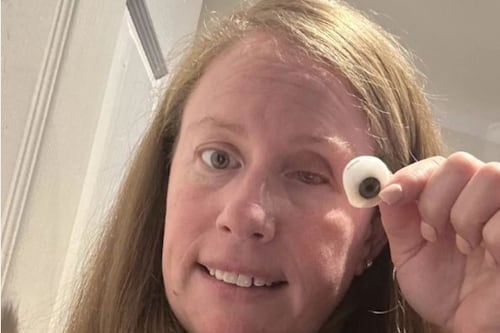 Mujer pensó que tenía mugre en el ojo pero le extirparon por esta terrible enfermedad