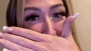 Influencer gastó casi USD 2.000 para tener la “sonrisa perfecta” pero el resultado no fue el esperado