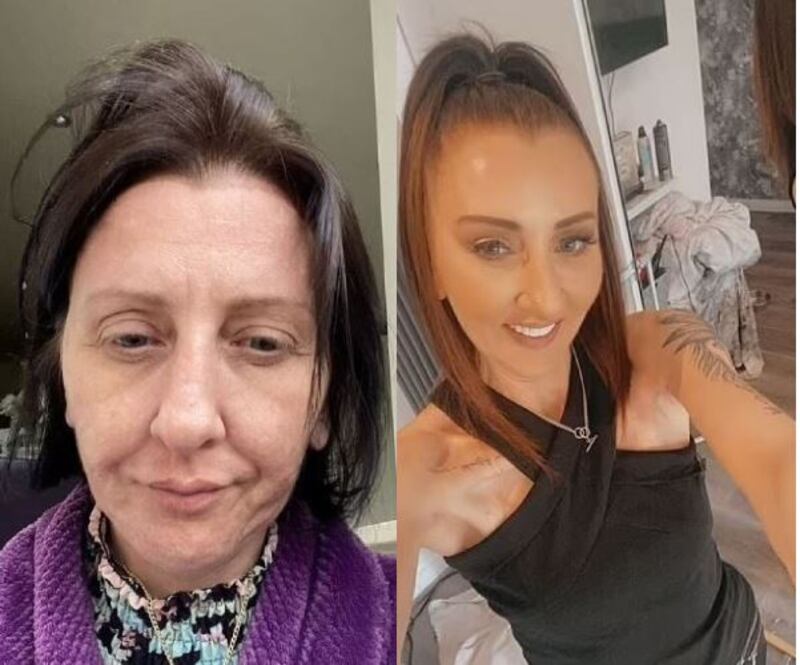 Antes y después de Emma Sheppard