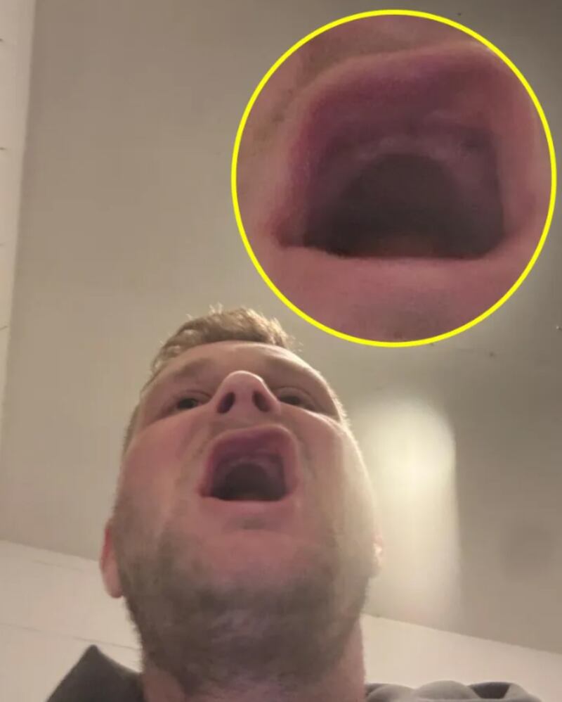 Viajó para arreglarse los dientes y terminó sin poder comer. Foto: The Sun