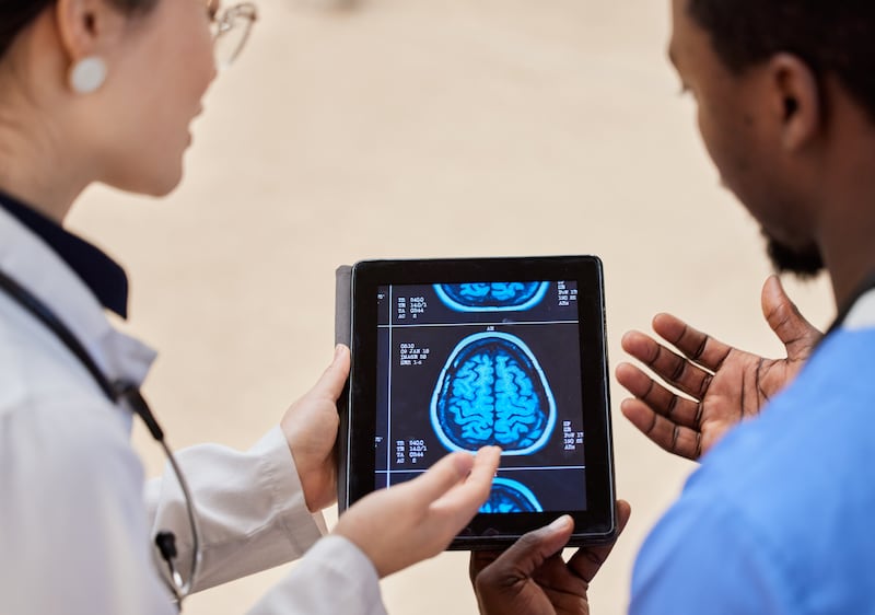 Resonancia magnética del cerebro
