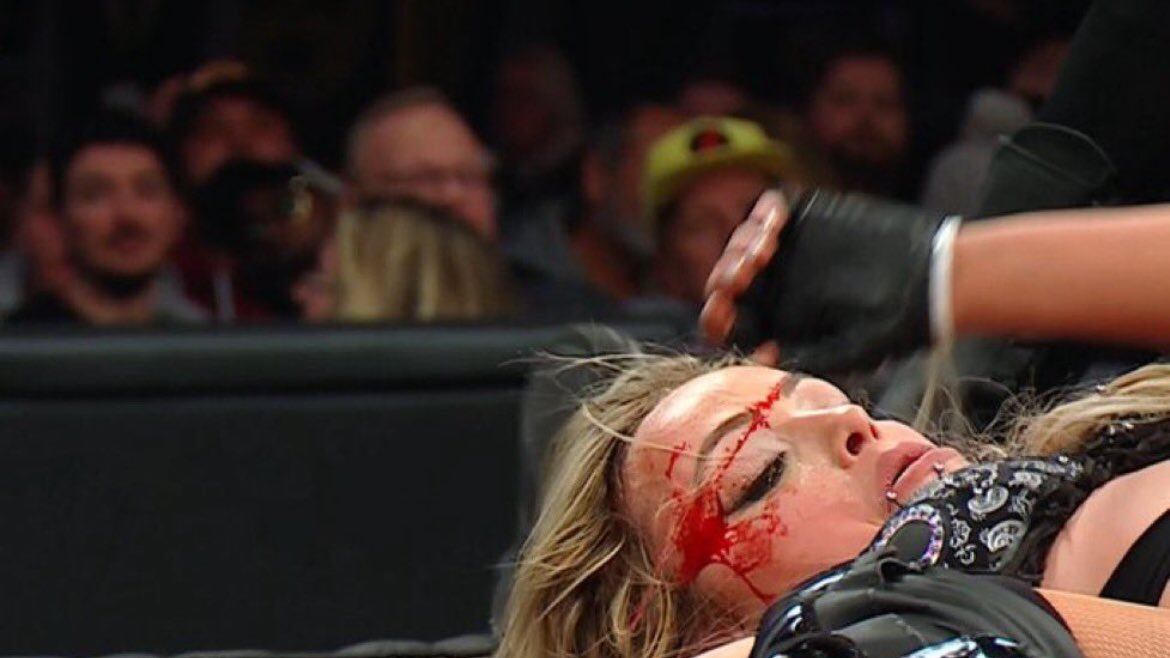 Liv Morgan sufre herida en su cara después de combate de WWE.