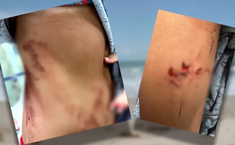 Heridas de Ella Reed