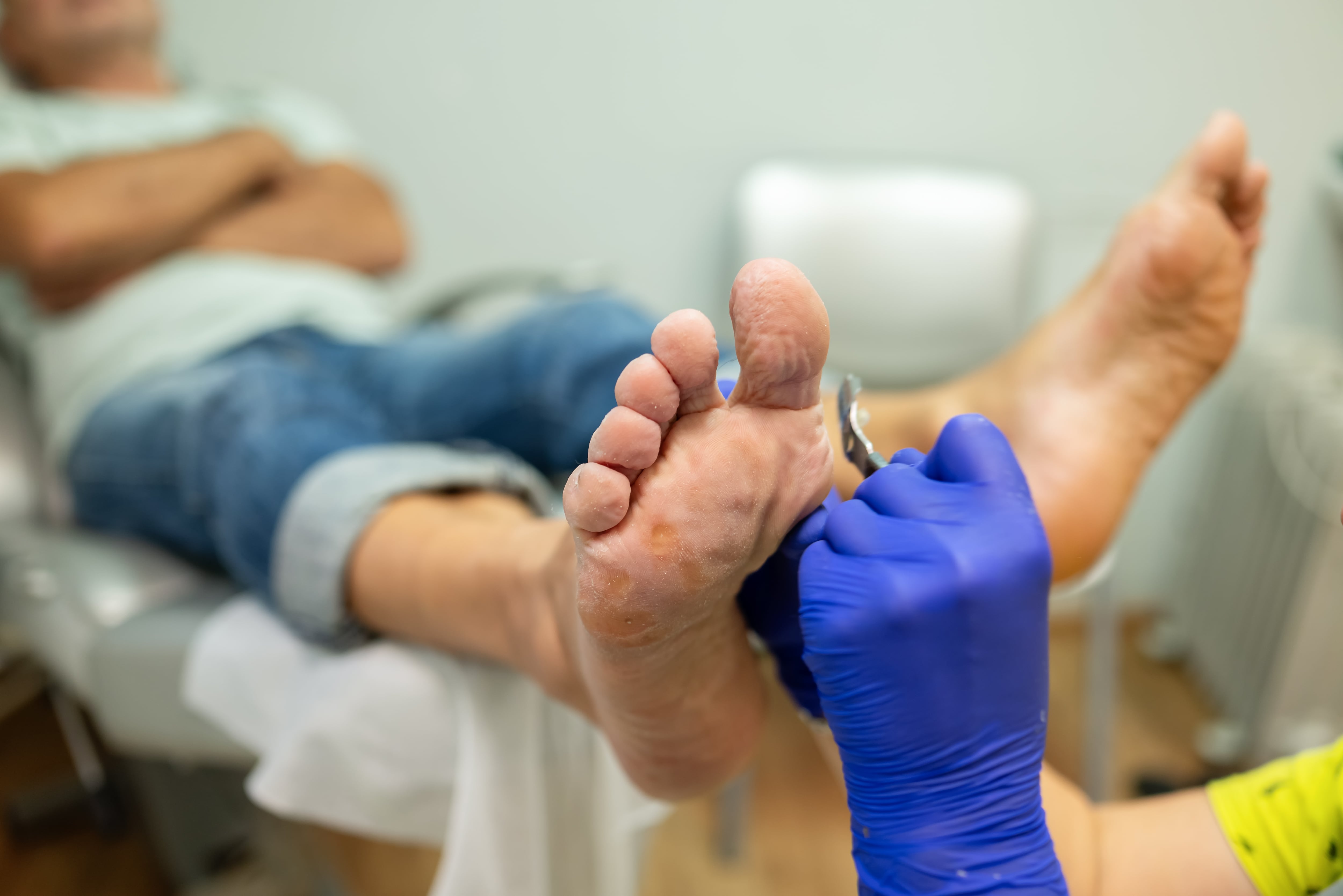 El cuidado adecuado de los pies ayuda a prevenir callos y molestias al caminar.