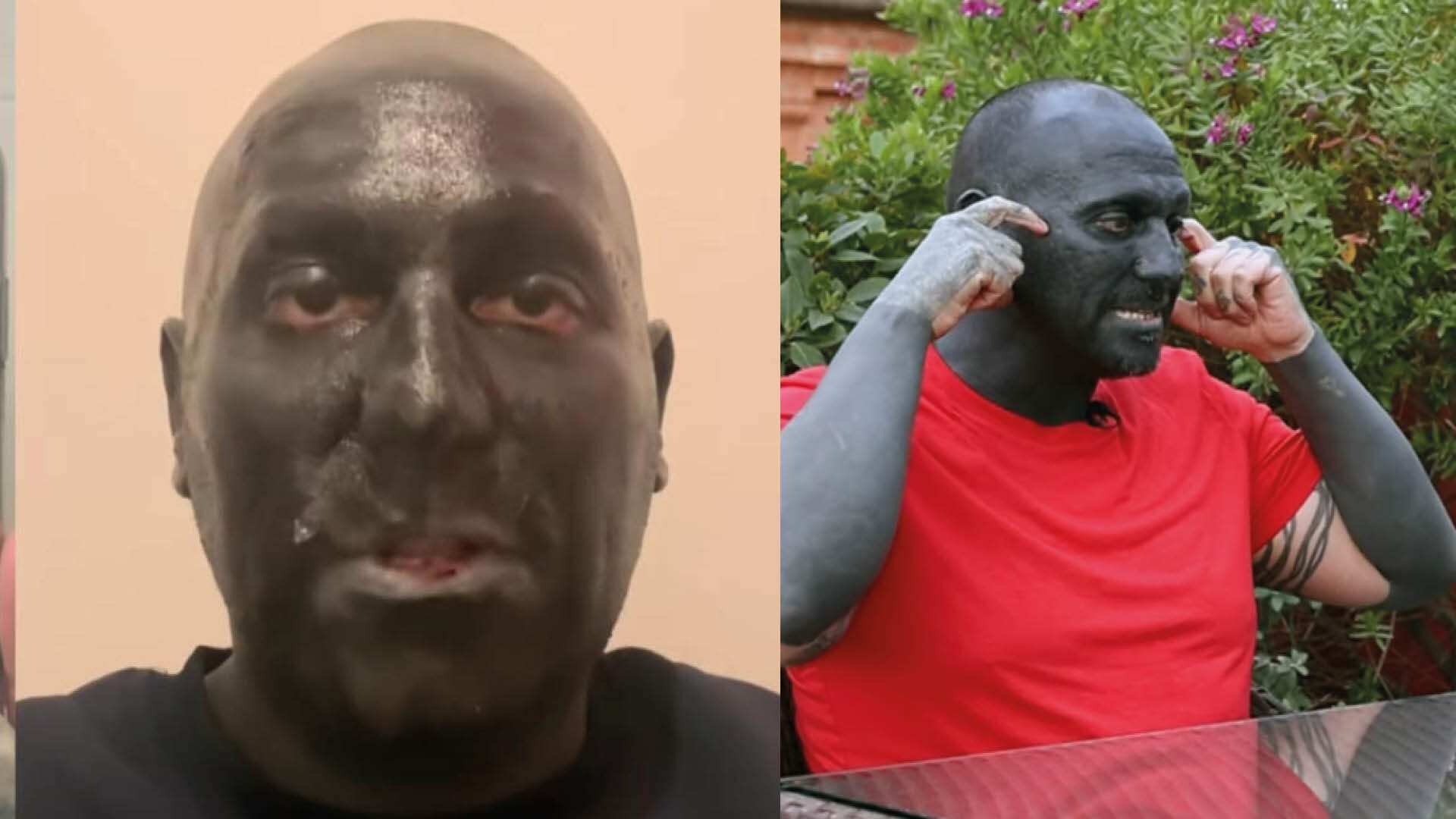 Repudian a hombre que se tatuó de negro la cara y la cabeza de negro; así luce