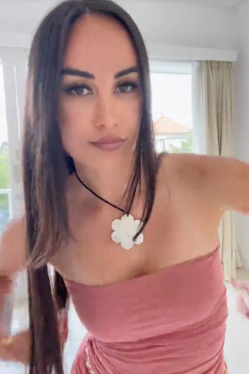 Así lucía modelo antes de operarse su rostro, a reducción de frente y fox eyes