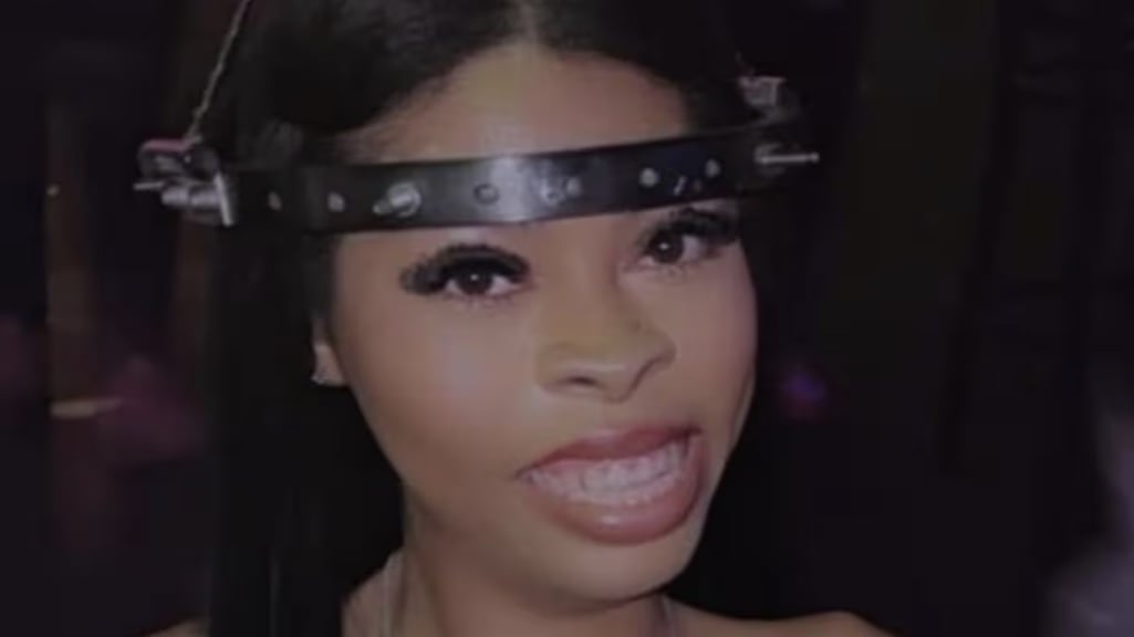 Mujer tiene 15 tornillos colocados en el cráneo para mantenerse con vida: no le daban más de 7 años