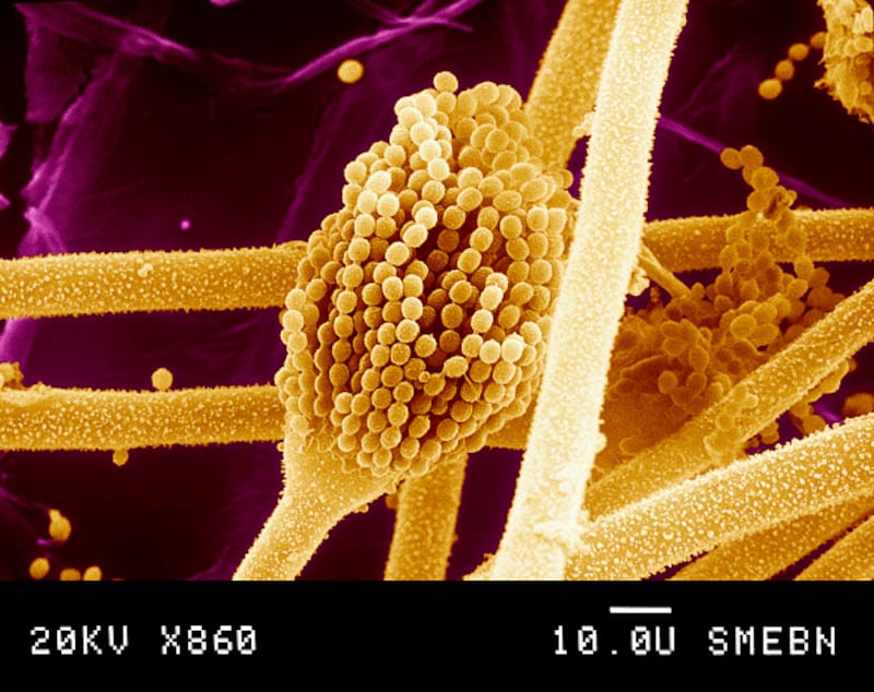 Aspergillus flavus.