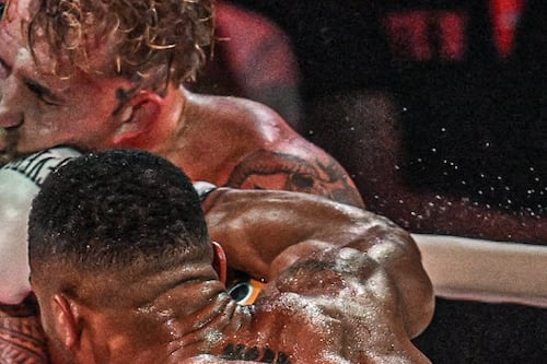 Así quedó Jake Paul después de su fractura de mandíbula al enfrentar a Anthony Joshua