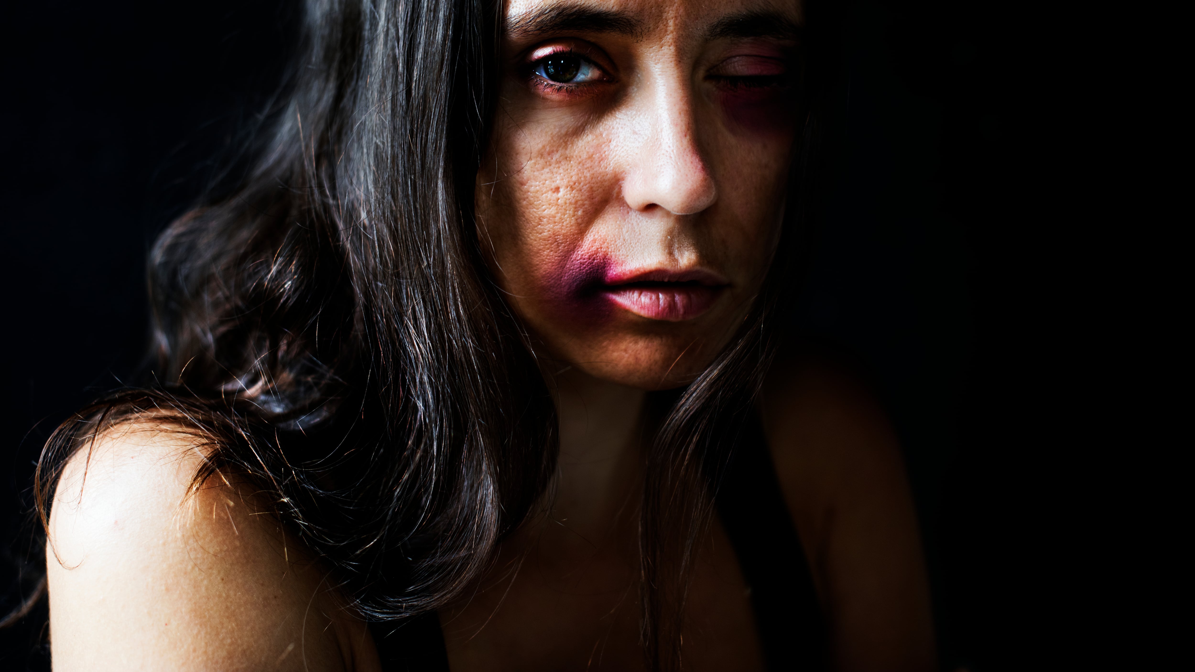 Madre agrede brutalmente a maestra de primaria, que podría perder un ojo