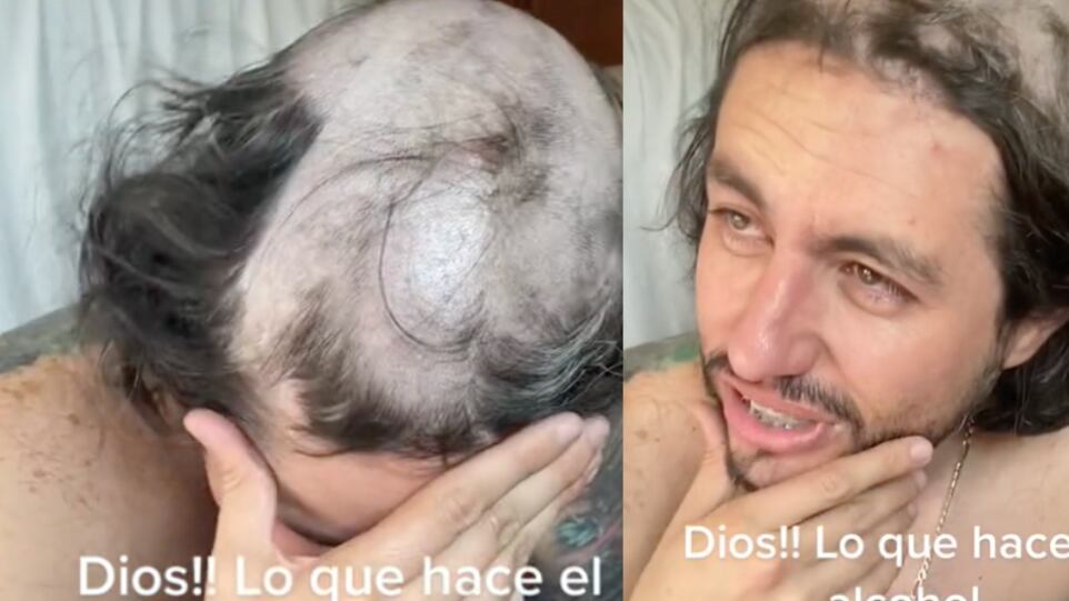 Llegó ebrio a la casa y sus hijos lo raparon mientras dormía