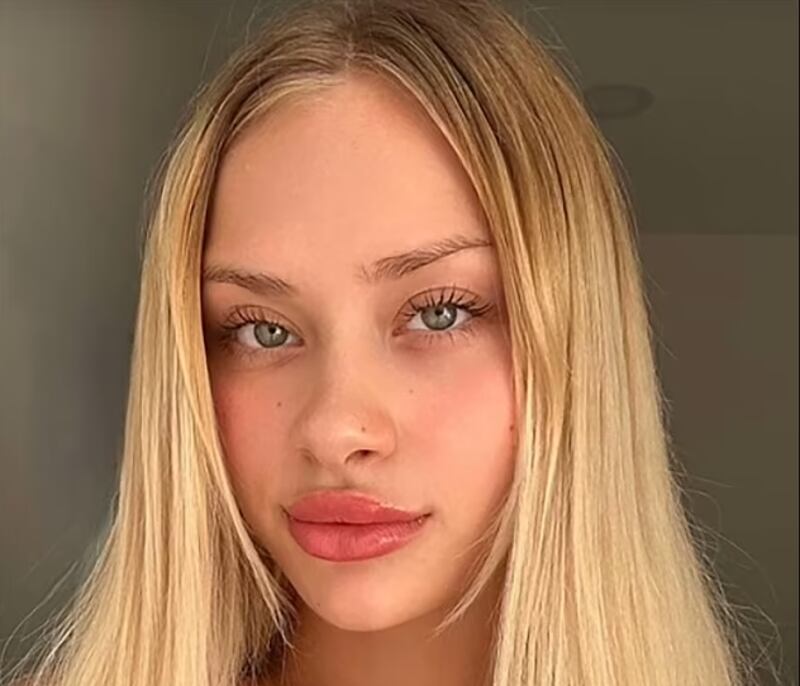 Maria Kovalchuk, modelo que apareció gravemente herida en Dubai
