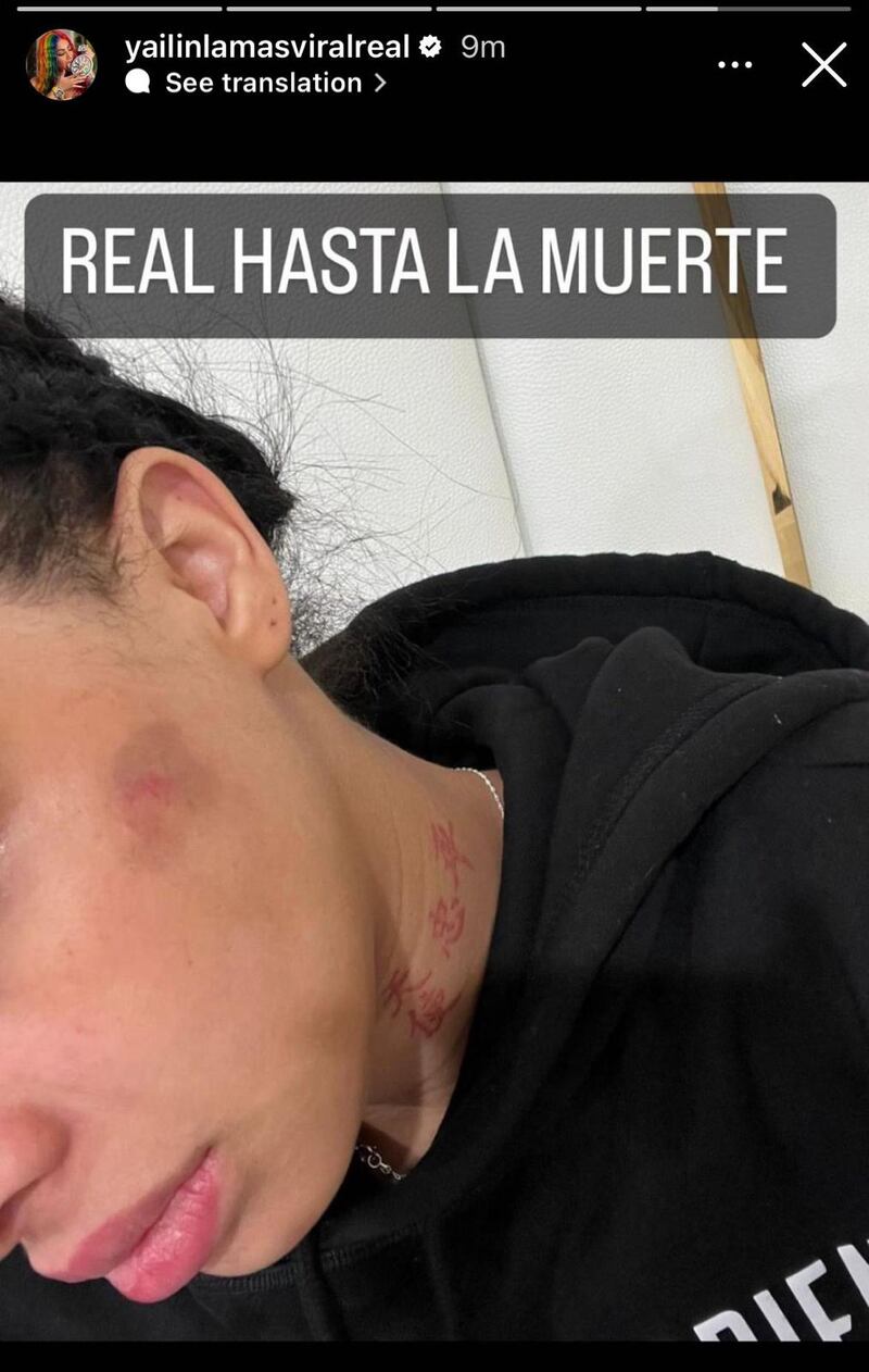 Yailín "La Más Viral"