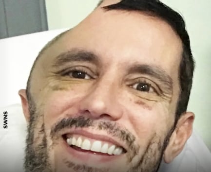 De un tropiezo a una misión: La increíble recuperación de Alastair Wallace