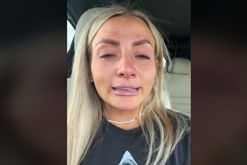 Quiso lucir bella con botox antes de su boda y sólo sufrió la tortura