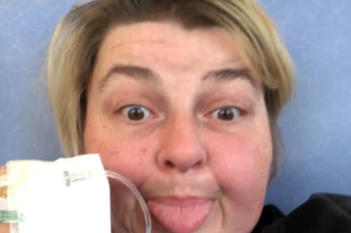 Mujer con un extraño cáncer de boca reveló el síntoma que dejó pasar