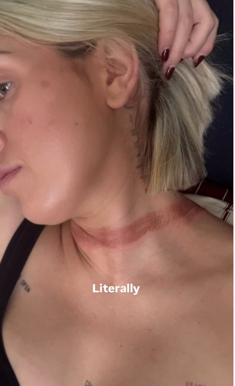 Influencer casi muere estrangulada por su larga bufanda que se enredó en las llantas de un auto