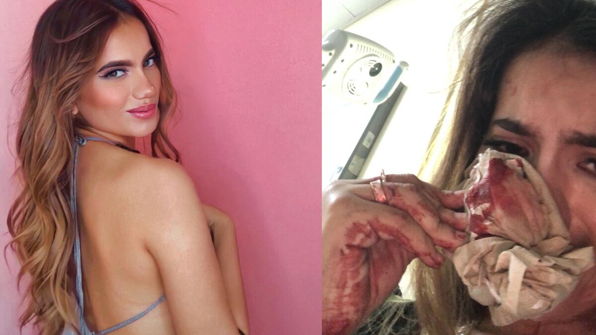 Influencer y modelo que fue agredida