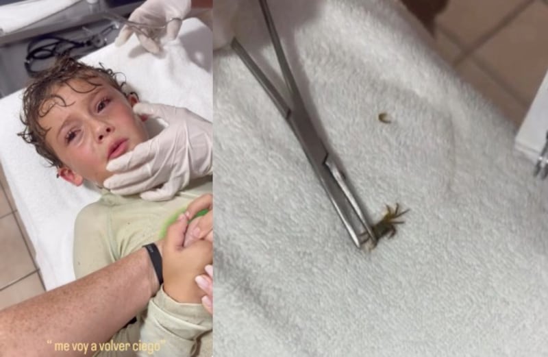 Niño en Cancún se salva tras cangrejo entrar en su oído; video se vuelve viral en redes