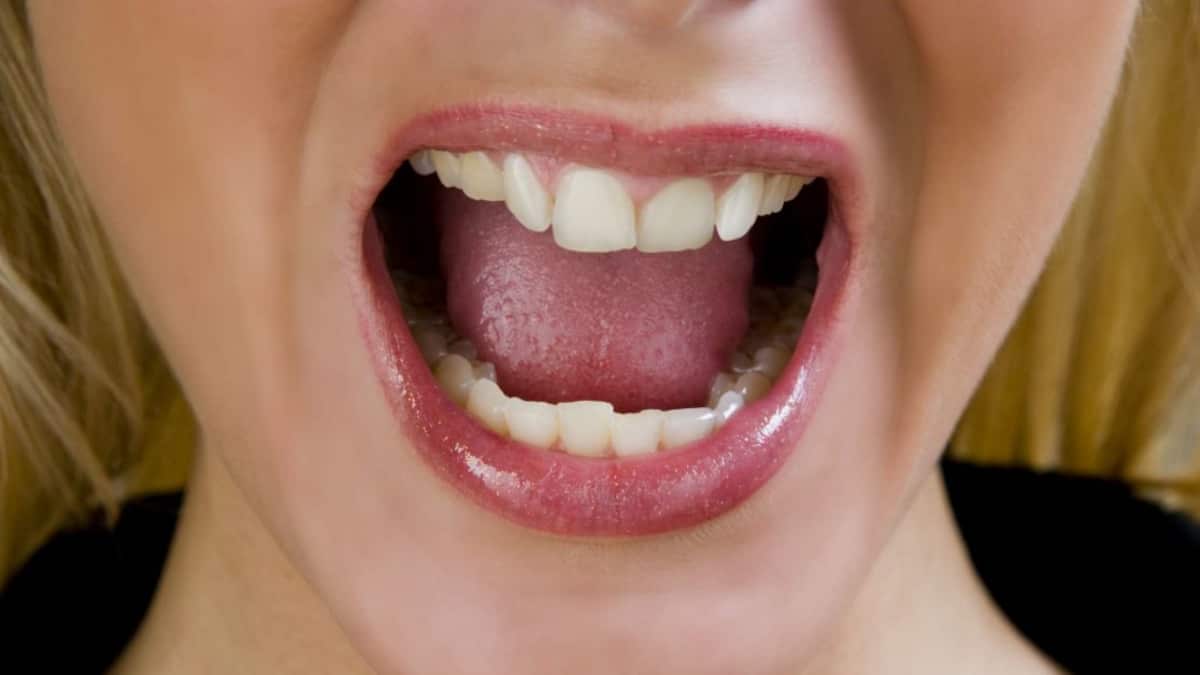 La lengua quemada incide en el desequilibrio.