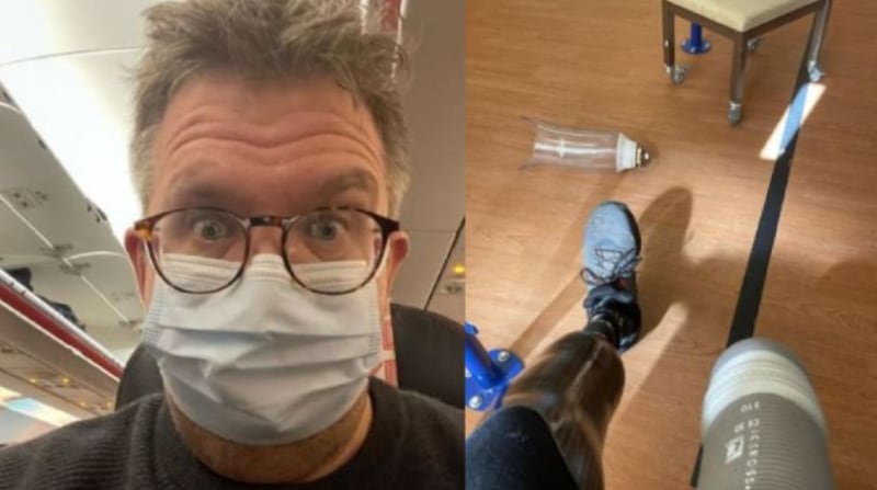 Hombre inspiró a un cirujano a cortarse sus propias piernas