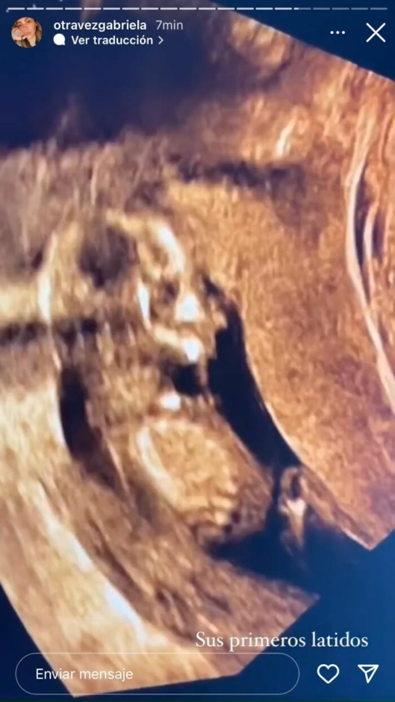 Gabriela Sevilla mostró ecografías falsas a su pareja, asegura ginecólogo que la atendió y denuncia que falsificó su sello médico