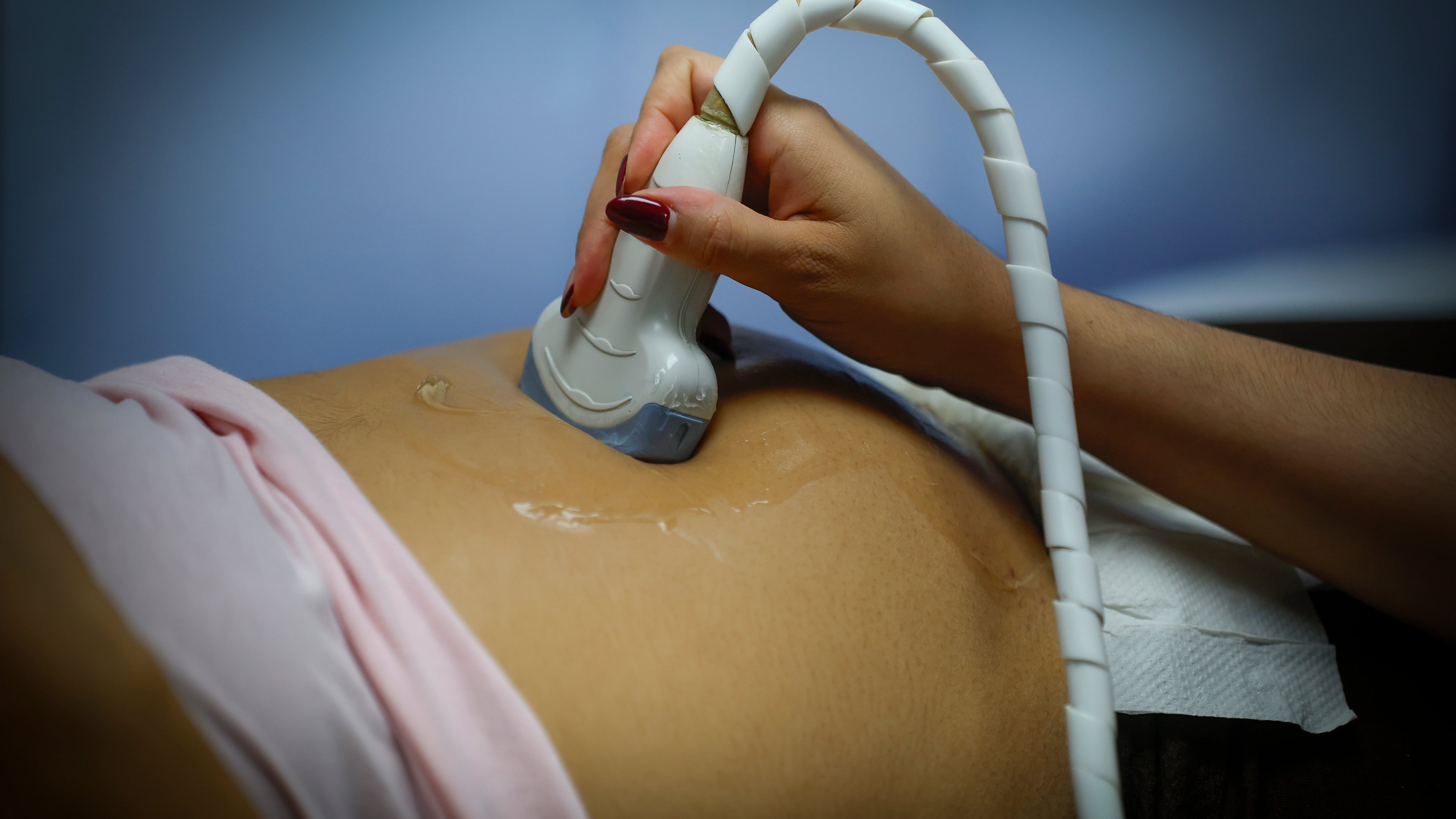 Fotografía de archivo de una mujer embarazada que se realiza una ecografía. EFE/ Francisco Guasco
