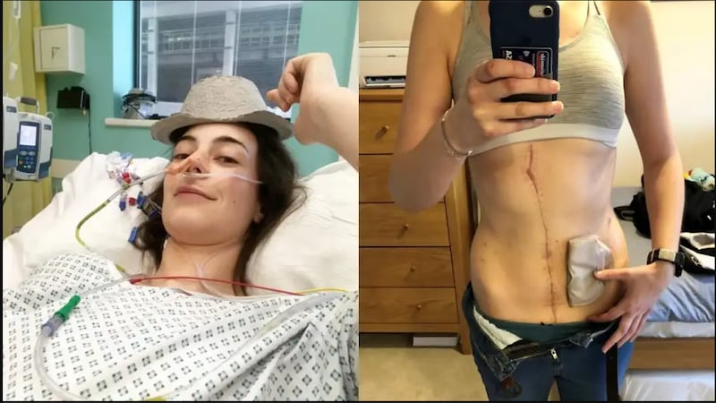 Cáncer abdominal