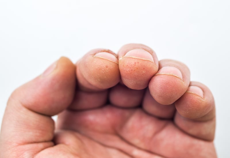 uñas