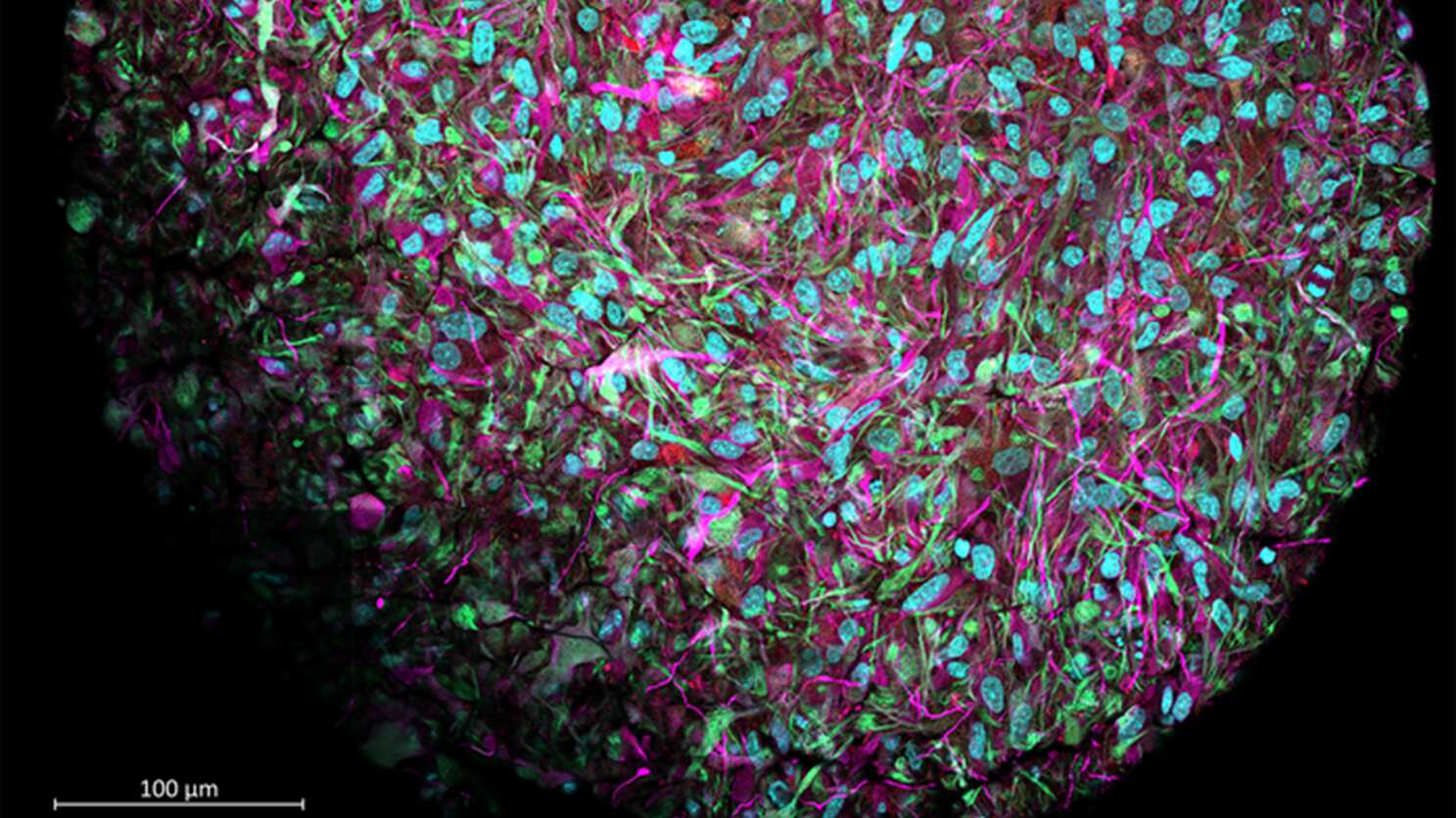 Organoides cerebrales