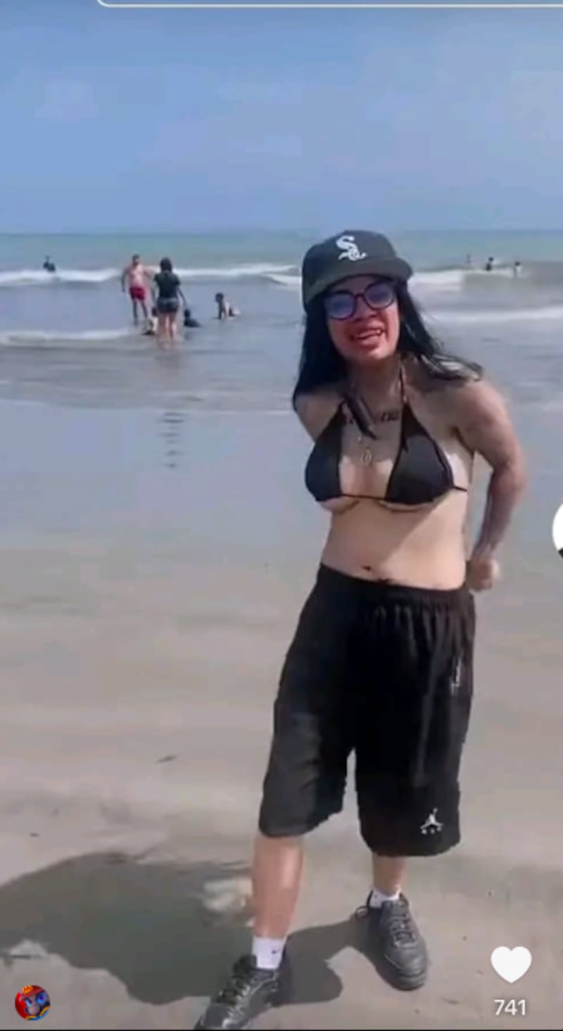 Samanthrux antes de la cirugía