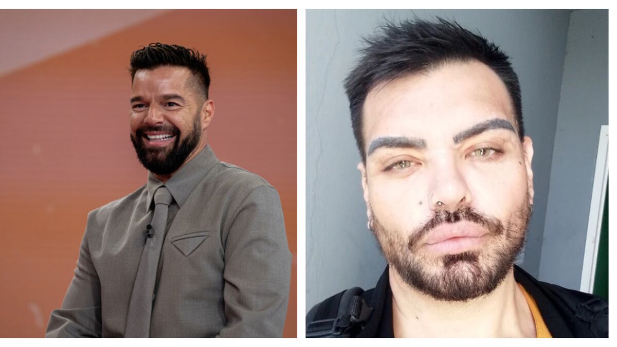 Hombre se opera más de 30 veces y gasta millones para quedar parecido a Ricky Martin: admite que sigue sin lograrlo