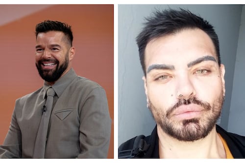 Hombre se opera más de 30 veces y gasta millones para quedar parecido a Ricky Martin: admite que sigue sin lograrlo