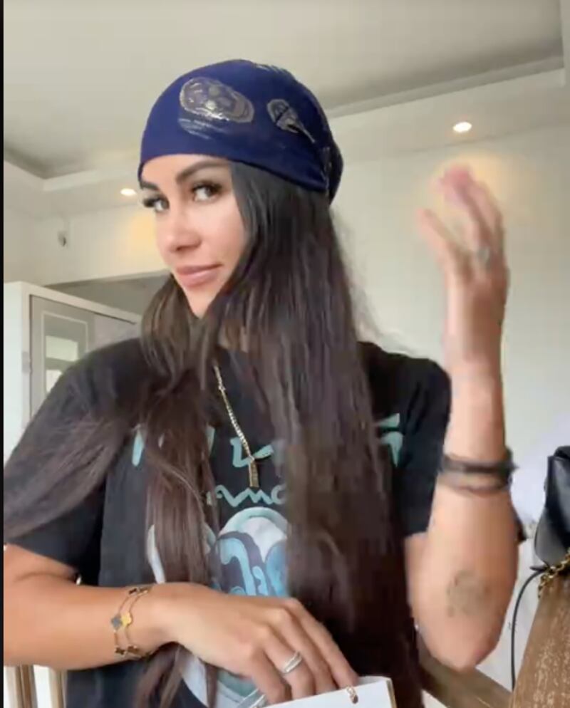 Así lucía modelo antes de operarse su rostro, a reducción de frente y fox eyes